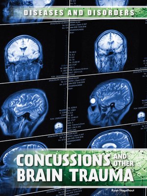 cover image of Concussions and Other Brain Trauma